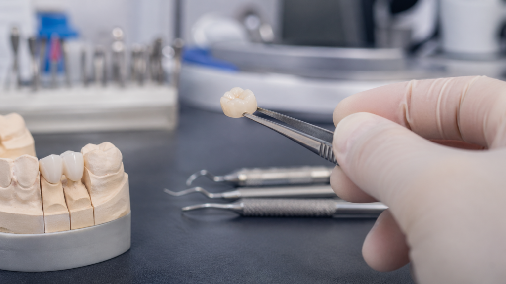 priebeh zhotovenia mostíka na zuby